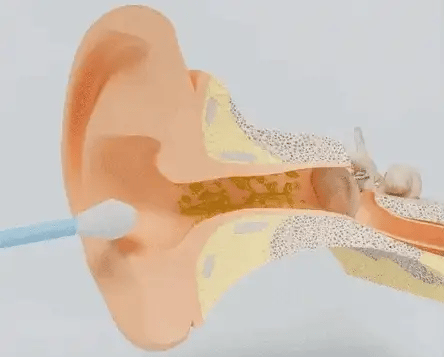 Reusable Ear wax
Cleaner Stick