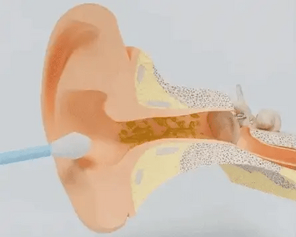 Reusable Ear wax
Cleaner Stick