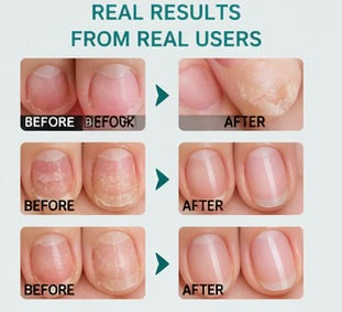 Before and after comparison of nail care treatment on real user's nails.